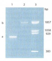 Obr. 10: Výsledek elektroforézy DNA [23[ Obr.