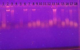 běh DNA Detekce přítomnosti DNA běh DNA kmene Detekce přítomnosti DNA 1 L. acidophilus CCM 4833 +/- 11 L. casei LOCK 0919 +/- 2 L helveticus CCDM 714/00-P + 12 L. rhamnosus LOCK 0908 +/- 3 L.