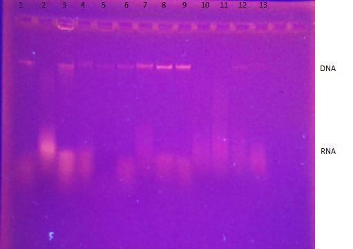 plantarum CCM 7039T +/- 7 L. gasseri K7 +/- 17 L. kefiry CCM 7086 + 8 L. gasseri K7 CCM 7009 + 18 L. amylovarum CCM 4380 + 9 L. paracasei spp. paracasei CCDM 213/06 +/- 19 L. lactis CCM 7414 + 10 L.