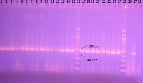 5.3 Stanovení citlivosti PCR Vybrané vzorky bakteriální DNA byly podrobeny amplifikaci DNA pomocí konvenční PCR specifické pro doménu Bacteria (primery F_eub a R_eub) [7] a pro rod Lactobacillus