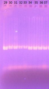 PCR reakce probíhala podle programu Eubacter (Tab. 9) a namíchání PCR směsi je zapsáno v Tab.