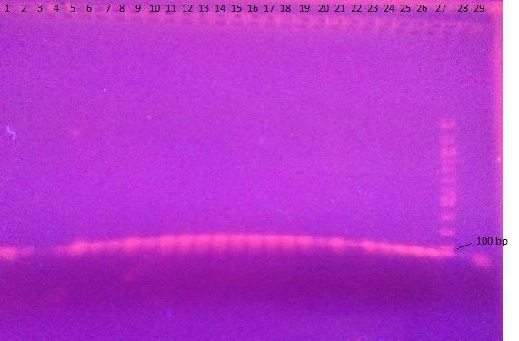 Ve všech vzorcích byl v různé intenzitě detekován specifický produkt PCR (466 bp), tím byla prokázána přítomnost bakteriální DNA. 5.3.