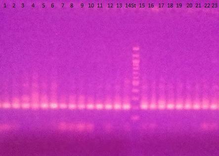 Po analýze qpcr-hrm s primery V3F/V3R [43] byla následně provedena agarózová gelová elektroforéza (Obr. 24). č. Vzorek Detekce PCR produktu č. Vzorek Detekce PCR produktu 1 L.