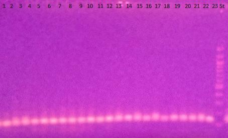 všech analyzovaných vzorků viz Tabulka 16. Po analýze qpcr-hrm s primery V3F/V3R [43] byla následně provedena agarózová gelová elektroforéza (Obr. 25). č. Vzorek Detekce PCR produktu č.