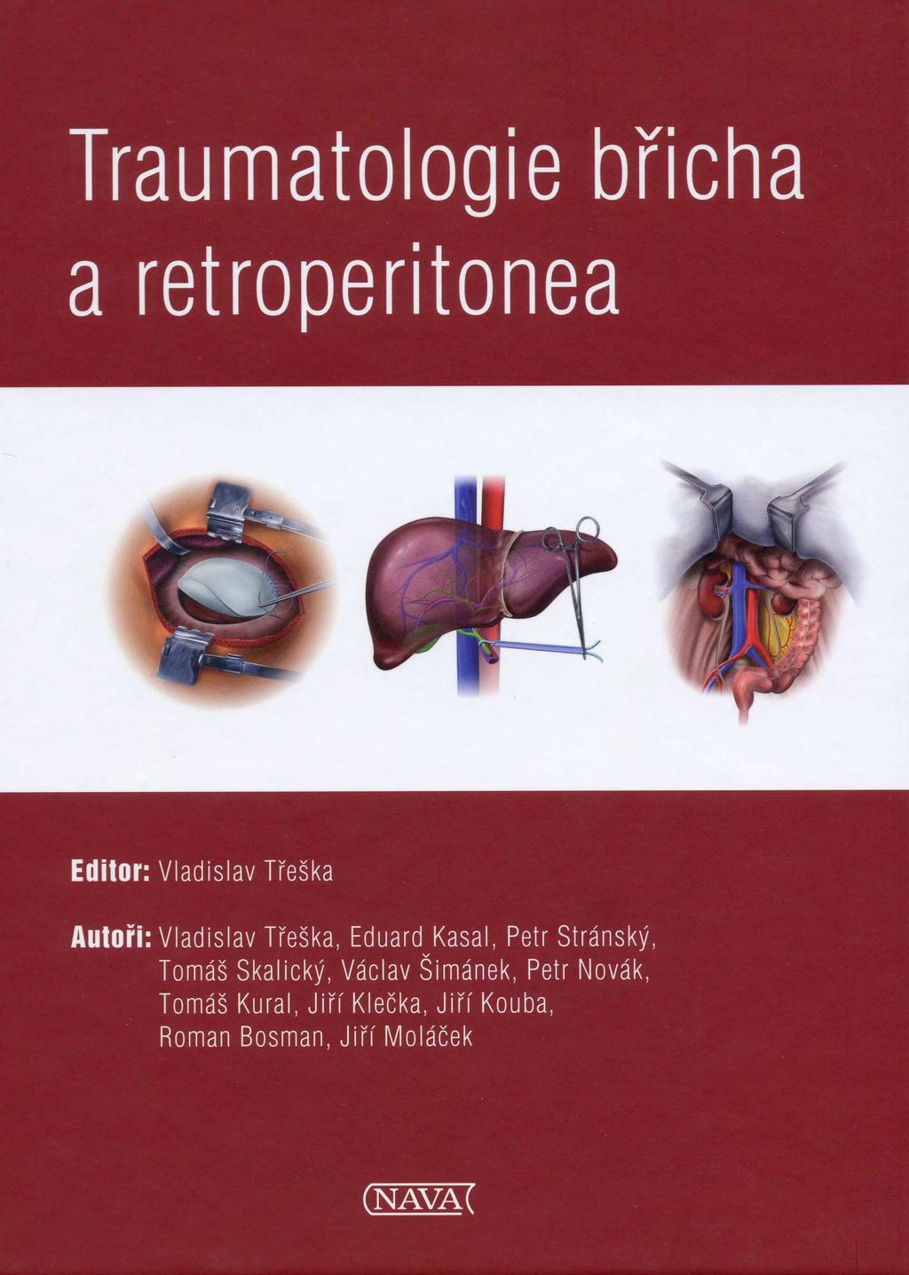 Právě vychází Třeška V. a kol. Traumatologie břicha a retroperitonea, Nava, 2013, 139 s.