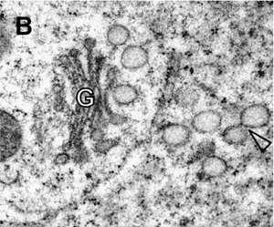 TGN časný endozóm - přijímá váčky od PM a trans GA - stýká se zde sekretorická a endocytotická dráha - částečně recyklující