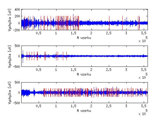 Obr. 7.9: Spánkové EEG signály s označenými počátky K-komplexů dle hodnocení experta Obr. 7.10: Blokové schéma klasifikace pomocí UNS 7.6.