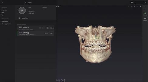 Kromě toho budete připraveni začít využívat sjednocující softwarovou platformu DTX Studio * pro 2D a 3D diagnostiku, která představuje novou éru digitální integrace pracovních postupů.