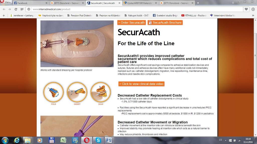 Obrázek 3: SecurAcath 300 300 SecurAcath. In: Interrad Medical [online].