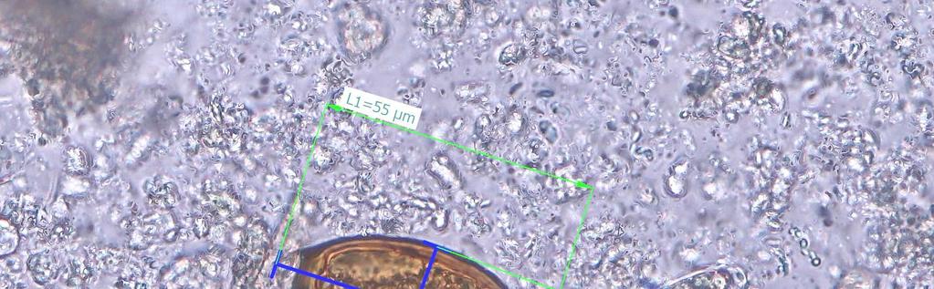 Obrázek 3: Vajíčka Trichuris trichiura Z 63 laboratoří výsledek správně určilo 57 (90%).