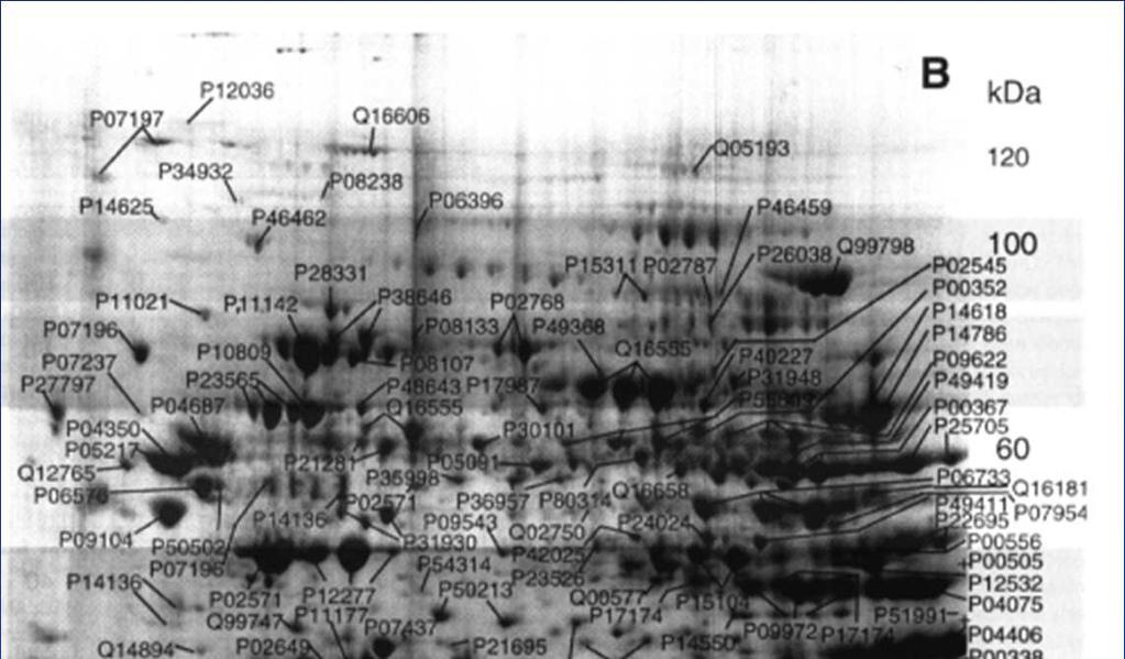 2-D proteinová mapa pi