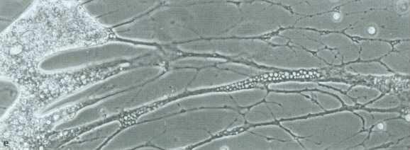 Rhizaria - panožky retikulopodia jsou síťovitá, na