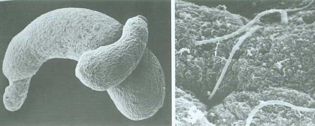 ARCHAMOEBAE - panoženky pouze 5 rodů v plazmě jsou symbiotické