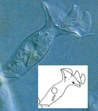 Řád: Chonotricha kolem cytostomu je spirálně stočený límeček