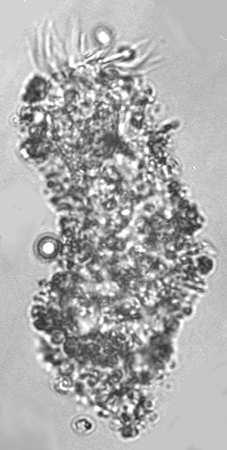 planktonu Codonella cratera - urnička,