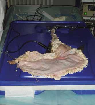 14. Erlangen stomach model suitable for training in various endoscopic methods.