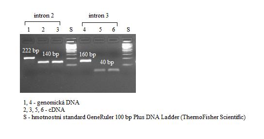 4. Očekávaná velikost amplikonů intronu 2 z genomické DNA je 222 bp a z nekontaminované cdna je 140 bp.