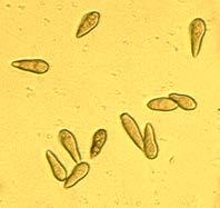 IV.2 Popis patogena V.