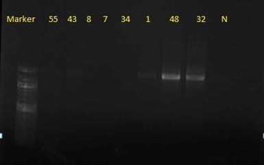 vysokou koncentraci amplifikovaných fragmentů DNA. Ve spodní části gelu jsou slabě viditelné pozůstatky nezreagovaných primerů, popř. se může jednat také o nízkomolekulární nespecifické produkty.