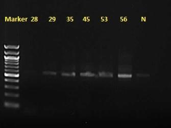 UTB ve Zlíně, Fakulta technologická 65 nespecifické produkty. V dráze se vzorkem DNA konsorcia z půdy č. 20 je vidět slabší band (odezvu). V dráze se vzorkem DNA konsorcia z půdy č. 11 je band viditelný, ale navíc je zde i minimální množství nespecifických produktů.