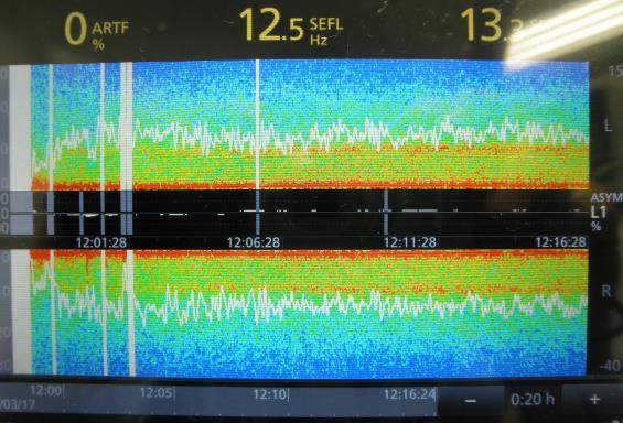 Hz 30 20 10 0 0 10 20 30 Hz SFNT,