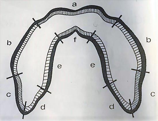 2.3.2 Dolní čelist Obrázek 4 Anatomie protézního lože mandibuly a) Retní úsek Retní úsek označuje oblast mezi špičáky.