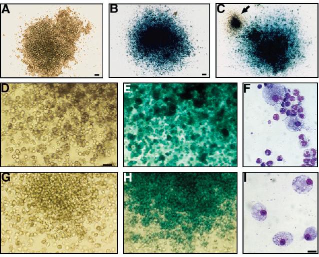 NSC jsou také schopny rekonstruovat hematopoézu (Bjornson 1999) A kolonie ze zdravé kostní dřeně; B,C kolonie z kostní drěně NSCs (ROSA) transplantovaných myší po ozáření; D,E