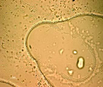 In situ bioremediation of contaminated soil and groundwater Table 1. Bacterial adhesion to motor oil, xylene and benzene and the predicted strain identification 3.RESULTS AND DISCUSSION 3.