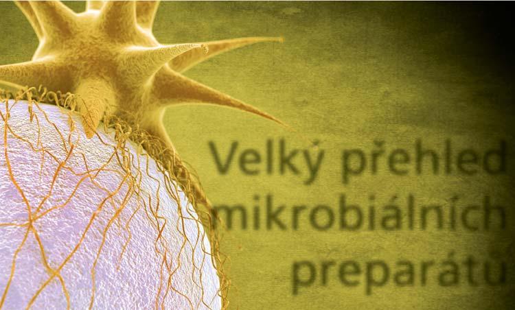 Dreny LiverDren, VelienDren, CorDren, UrinoDren, RespiDren, Supertox, Mezeg, Cranium, Cortex 2. Mikroorganismy Antivex, Nobac, Spirobor, Para-Para, Yeast 3.