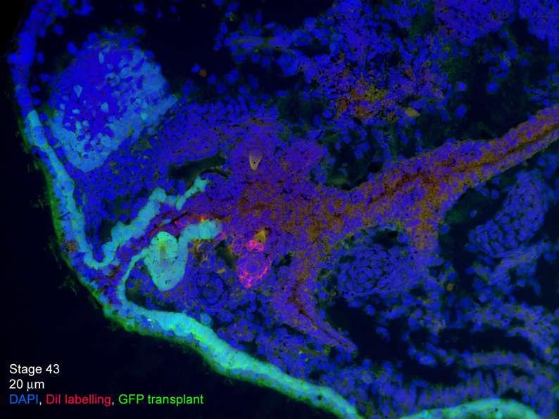 ECT GFP transplant +