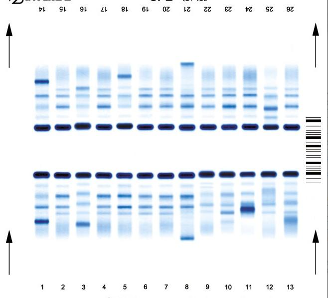 Výrobce Interlab (Itálie)-Analyzátor Microgel analyzátor G26 Migrační modul má 3