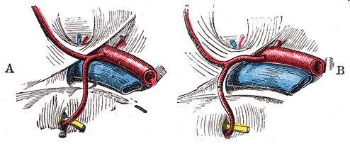 Arteria obturatoria 2.