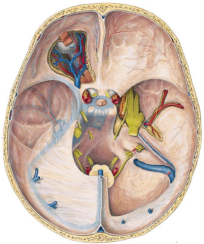 Arteria meningea media epidurální krvácení (úraz)