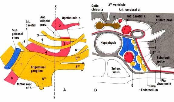 ACI pars cavernosa (segmentum C4)