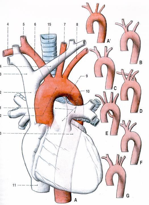 Variace větví arcus aortae a.