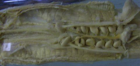 Truncusarteriosussrdce Eptatretus( Žaberníváčky
