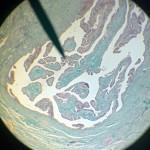 Cervix