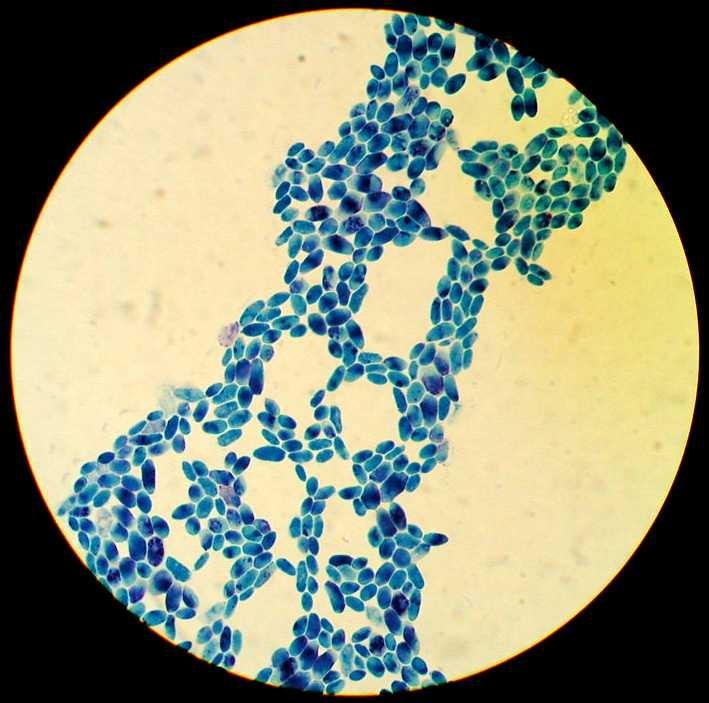 Takhle může vypadat výsledek (kvasinky): http://biology.clc.uc.