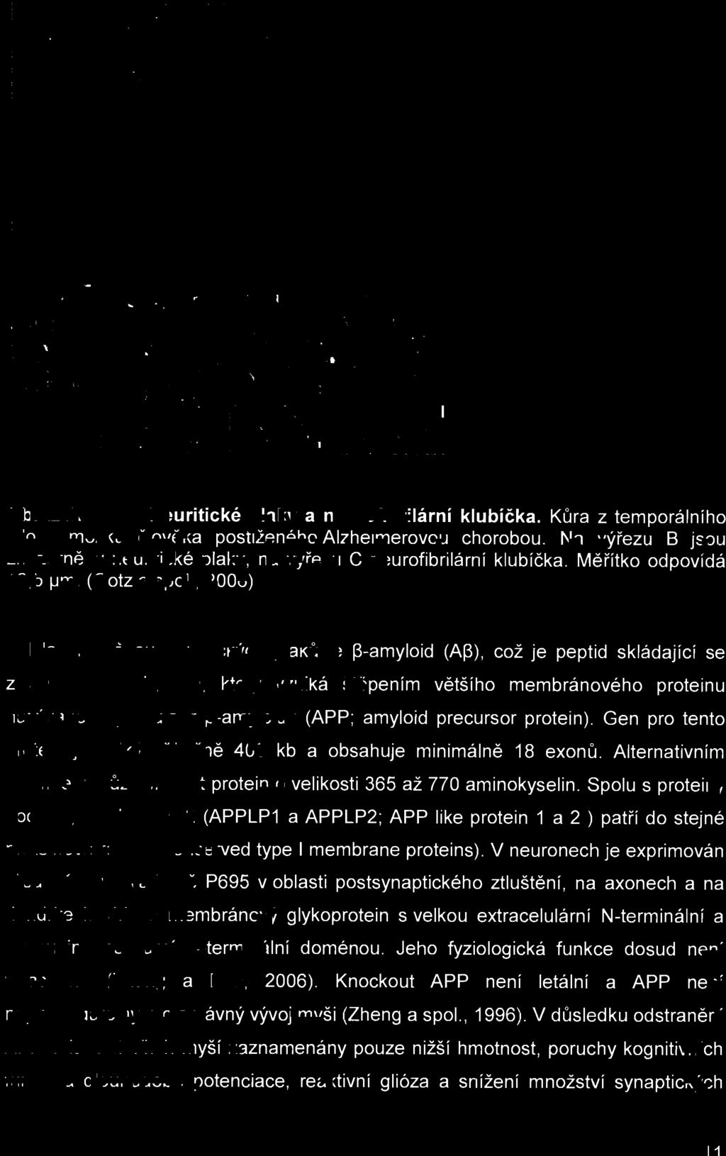 , 2006) Hlavní složkou neuritických pl ak ů je l3-amyloid (AI3), což je peptid skládající se z 39-43 aminokyselin, který vzniká ště pením většího membránového proteinu nazývaného prekurzor