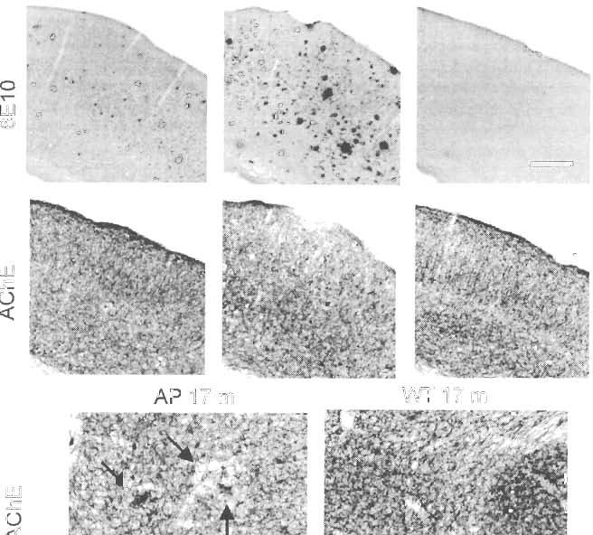 ]74 E. Machová el ol. / Neurobiology af Aging 29 (2008) 368-378 AP 7 m AP 17 m WT 17m o T"" W <D,. AP 17 m WT 17m Fig.4. ImmunohislOchcmical slaining for human.