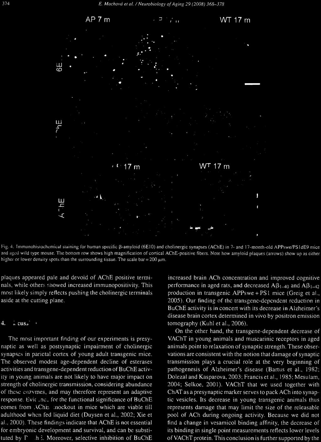 íon of conical AChE-positive fibers. Note how amyloid pl aques (arrows) show up 3S cither higher or lower density spot, than the surrounding tissue. The se ale bar = 200 f.lm.