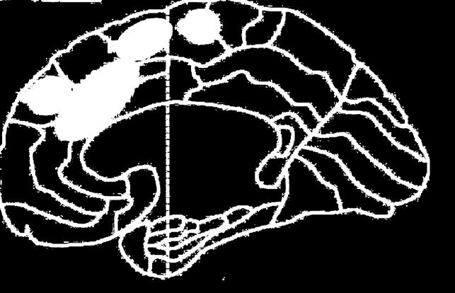 Neurální dynamika SoA po Guggisbergovi Po Guggisberg et al. 2011 Kaskáda: SMA => IPL => MC => SMA?