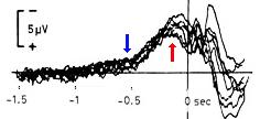 Readiness Potential The RP is a scalp-recorded slow negative shift in electrical potential generated by the brain and beginning