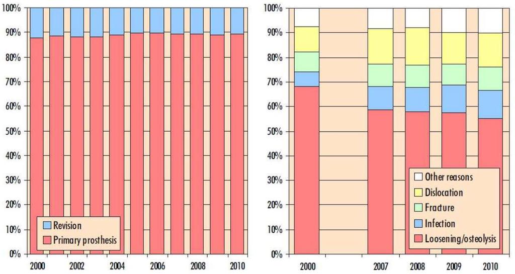 Úvod do problematiky Problematika životnosti náhrad a revizních operací Odhadovaná životnost náhrady 15 20 let U