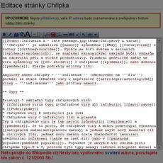 3. Pokud nejste zběhlí v editaci Wikipedia kódu, tak doporučuji před vlastní editací nového tématu Akromegálie si z již existujícího tématu např. Chřipka kód zkopírovat.