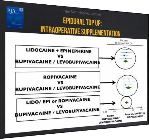 epidurální směs: lidocain 2% 18 ml +