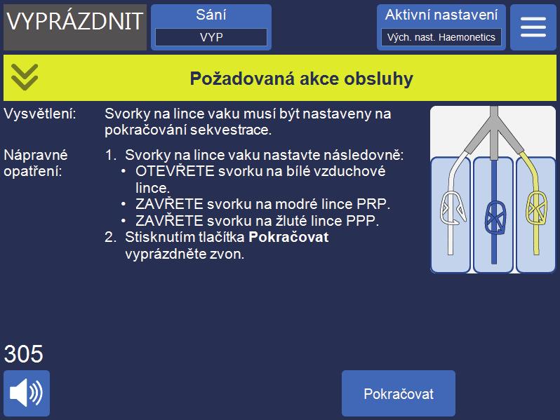 114 Kap. 6, Všeobecné použití: Sekvestrace Obrázek 59, Příklad výzvy sekvestrace Zařízení přečerpává erytrocyty ze zvonu do vaku na erytrocyty.