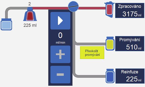 42 Kap. 2, Popis zařízení Diagram postupu Diagram postupu vizuálně informuje o stavu a pokroku v postupu.