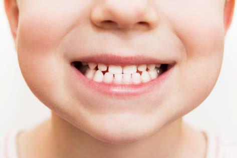 O zubu Funkce zubů Zuby jsou součástí dutiny ústní a slouží k uchopení, oddělení a rozmělnění stravy. Zásadní význam mají také pro řeč a estetický vzhled.