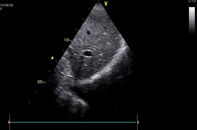 Diaphragma